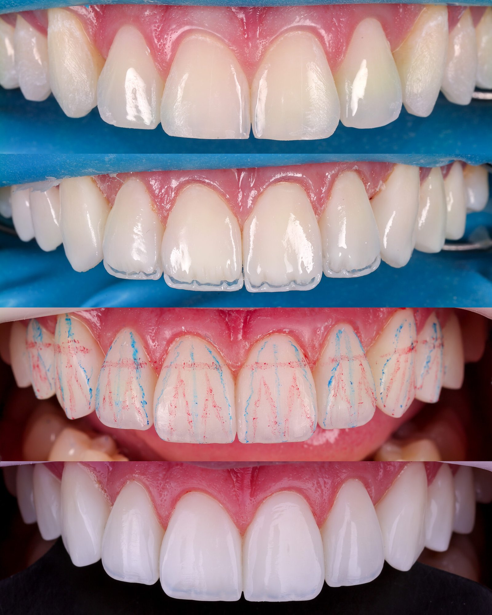photo-output 15